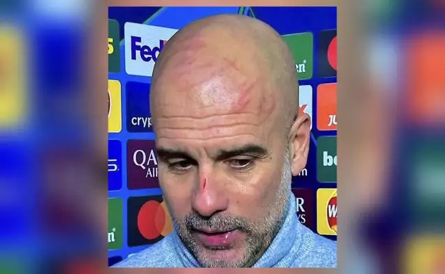 Pep Guardiola clarifies his ‘I want to harm myself’ comment after nose cut